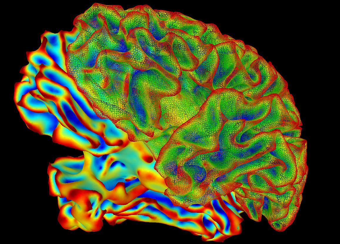 Multi-colored repesentation of a human brain in a black backgroun